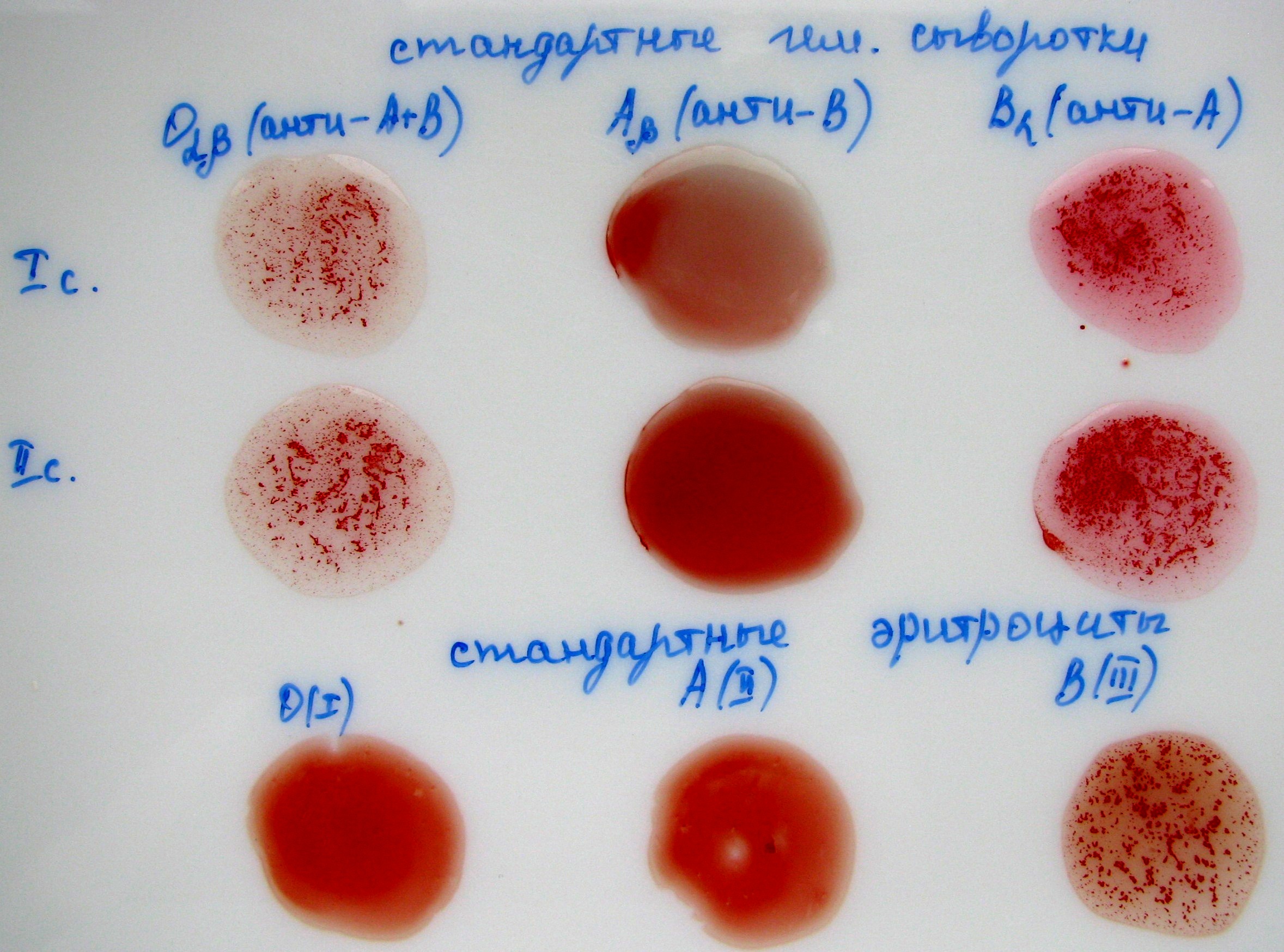 Группа крови агглютинация картинки