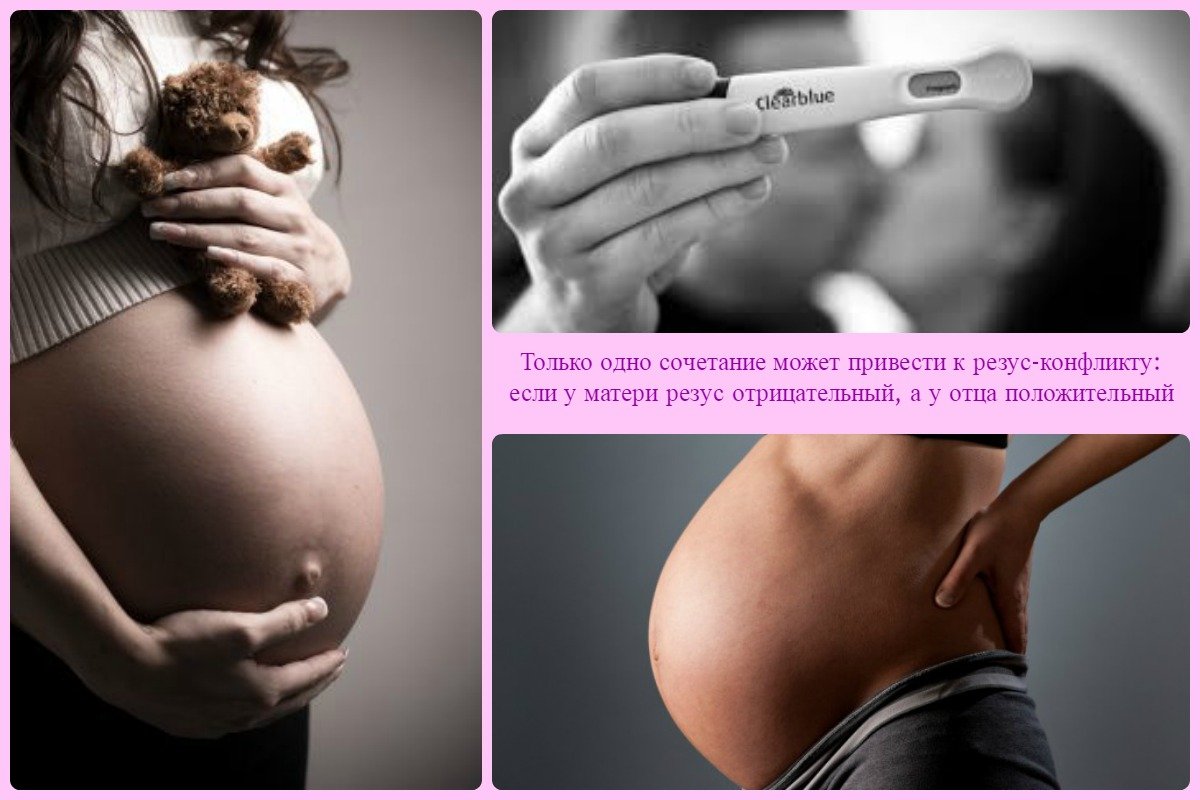 Беременность резус отрицательной матери. Резус беременность. Резус конфликт. Резус конфликтная беременность профилактика. Конфликт резус факторов при беременности.